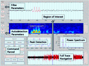 Development of Electroencephalogram (EEG) Signal Analyzer 이미지